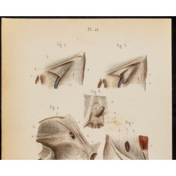 Gravure de 1846 - Aponévroses de l'aine, bassin, périnée - 3