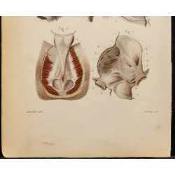 Gravure de 1846 - Aponévroses de l'aine, bassin, périnée - 4