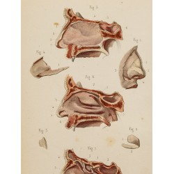 Gravure de 1846 - Cartilages du nez, fosses nasales - 2