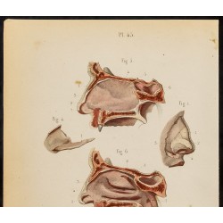 Gravure de 1846 - Cartilages du nez, fosses nasales - 3