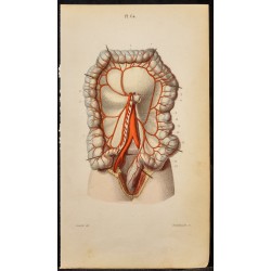 Gravure de 1846 - Artère mésentérique inférieure, coliques - 1