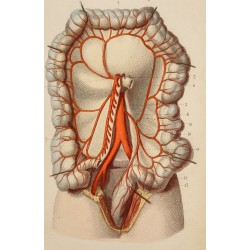 Gravure de 1846 - Artère mésentérique inférieure, coliques - 2
