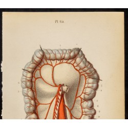 Gravure de 1846 - Artère mésentérique inférieure, coliques - 3
