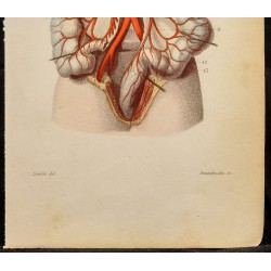 Gravure de 1846 - Artère mésentérique inférieure, coliques - 4