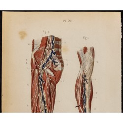 Gravure de 1846 - Vaisseaux et ganglions de la jambe - 3