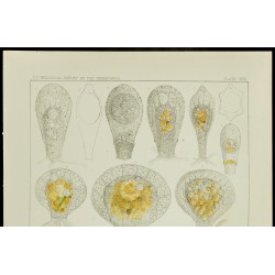 Gravure de 1879 - Lithographie d'amibes par Leidy - 2