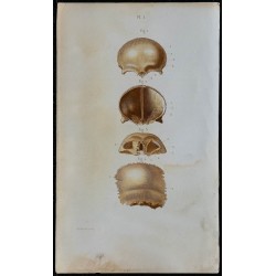 1852 - Os frontal et pariétal crâne 