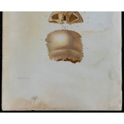 1852 - Os frontal et pariétal crâne 