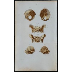 1852 - Os occipital sphénoïde temporal crâne 