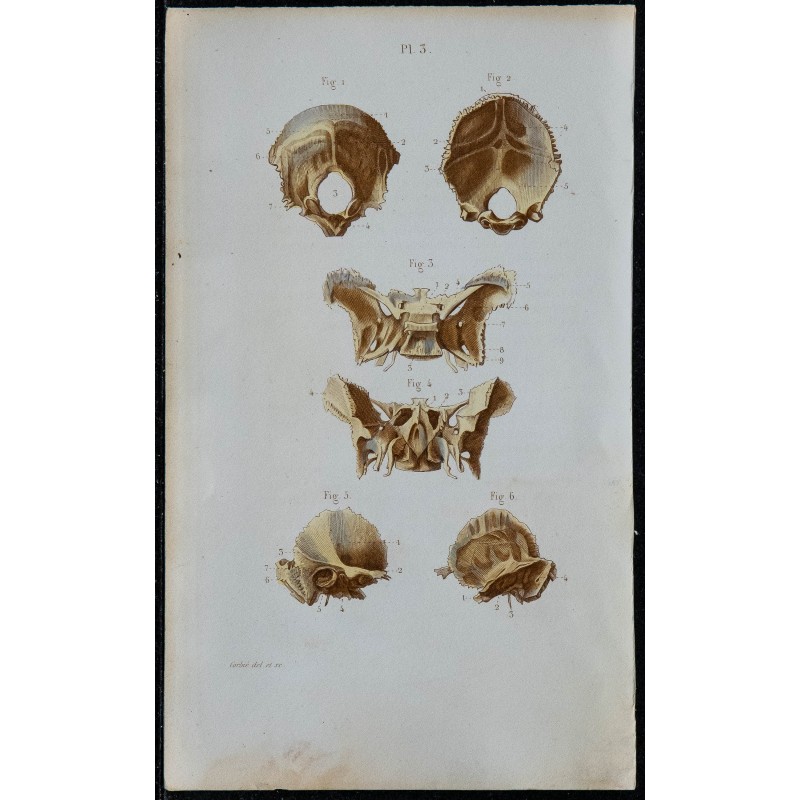 1852 - Os occipital sphénoïde temporal crâne 