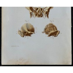 1852 - Os occipital sphénoïde temporal crâne 