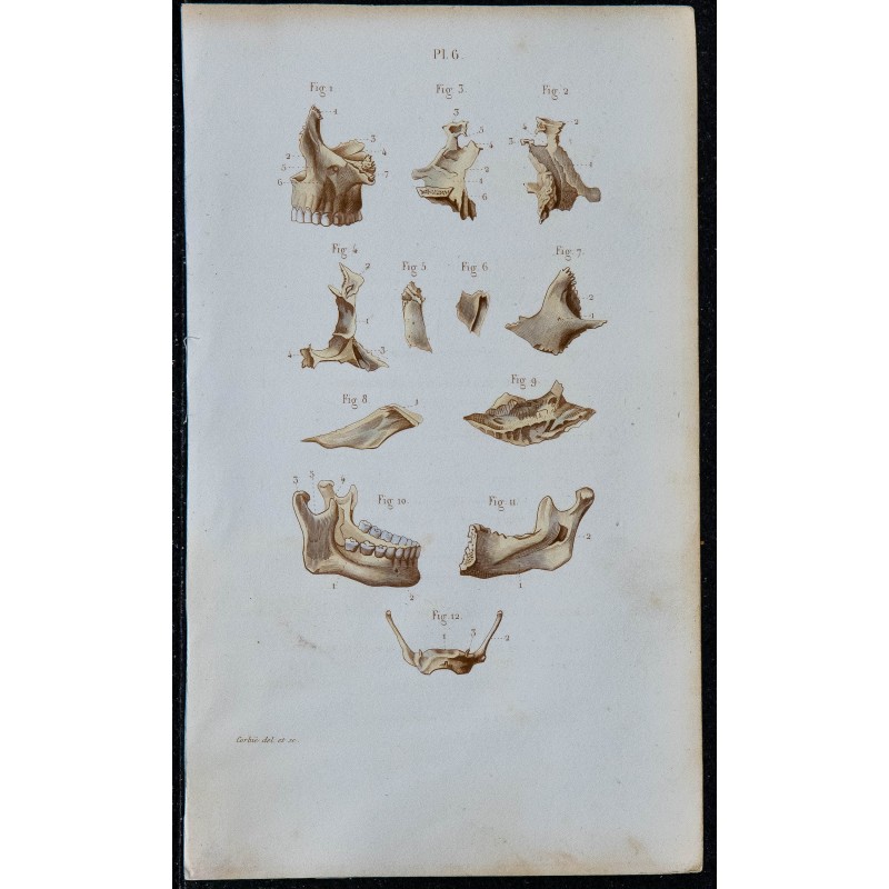 1852 - Os visage mâchoire hyoïde ensemble 1852 - Os visage mâchoire hyoïde ensemble