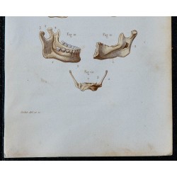 1852 - Os visage mâchoire hyoïde ensemble 