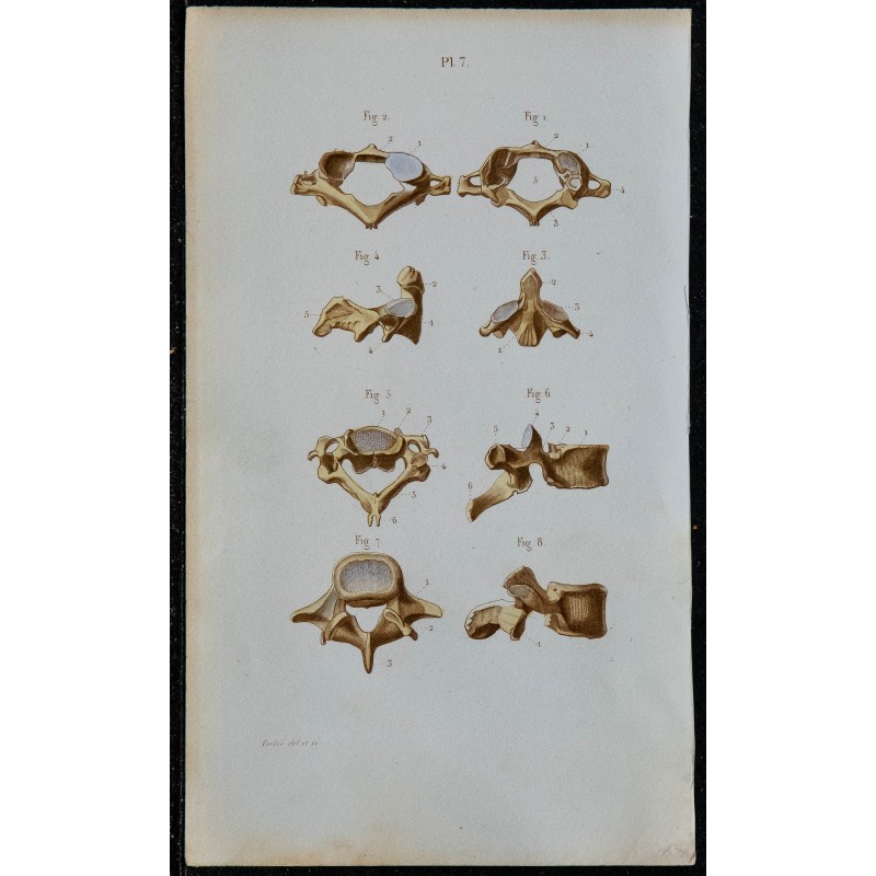 1852 - Vertèbres de la colonne vertébrale 