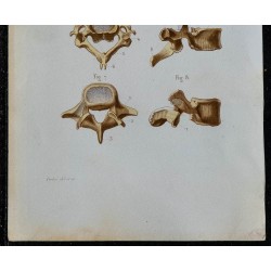 1852 - Vertèbres de la colonne vertébrale 