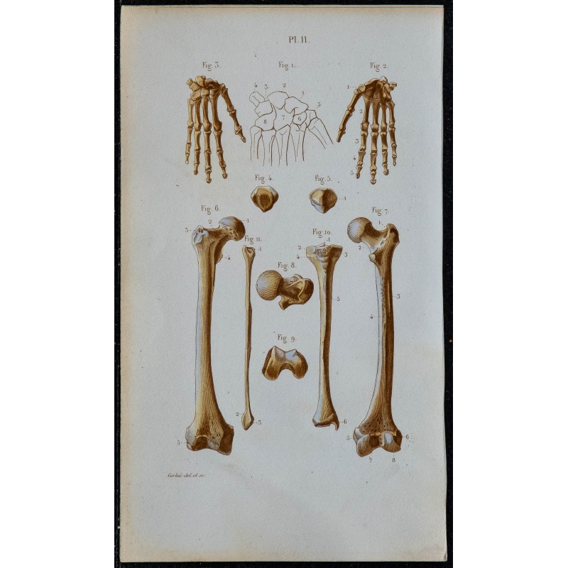 1852 - Main fémur rotule tibia péroné 