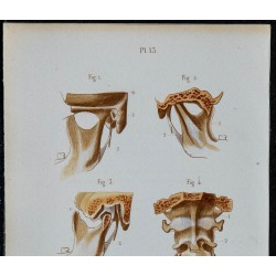 1852 - Articulation mâchoire atlas axis cervicale 