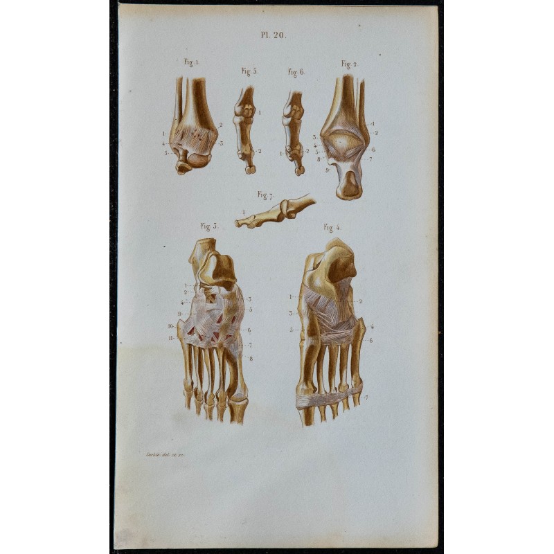 1852 - Articulation cheville et pied 