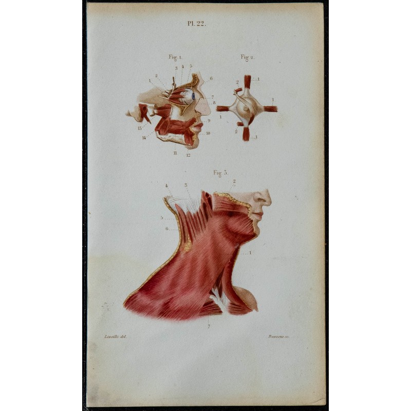 1852 - Orbitaires faciaux cou et œil 