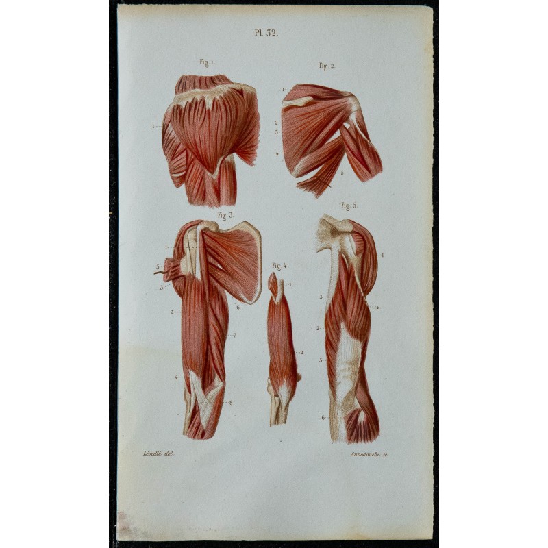 1852 - Épaule et bras musculature complète 