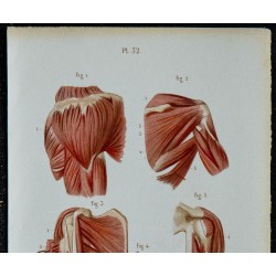 1852 - Épaule et bras musculature complète 