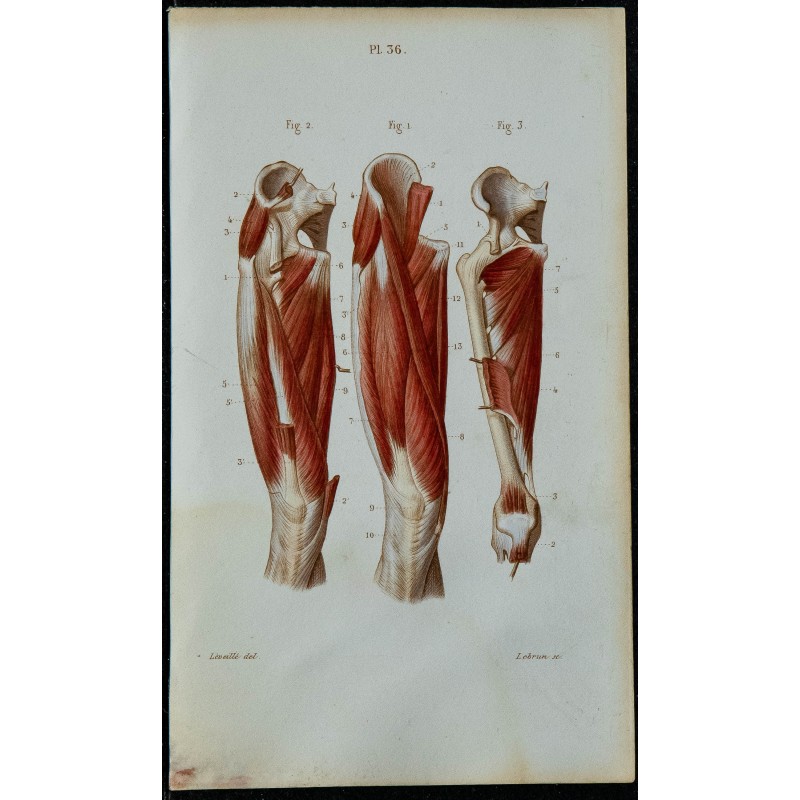 1852 - Cuisse muscles antérieure et interne 