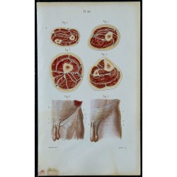 1852 - Coupes membres et aponévrose abdomen 