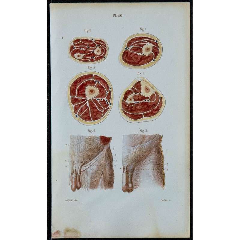 1852 - Coupes membres et aponévrose abdomen 