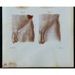 1852 - Coupes membres et aponévrose abdomen 