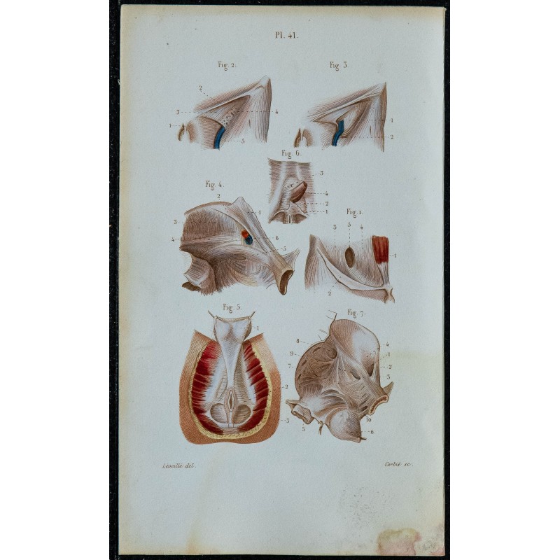 1852 - Aponévroses aine bassin périnée 