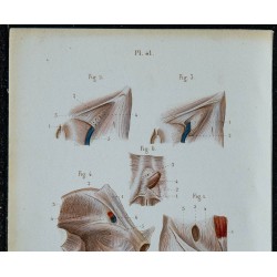 1852 - Aponévroses aine bassin périnée 