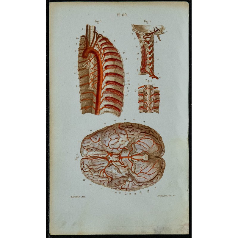 1852 - Artère vertébrale encéphale aorte thoracique 