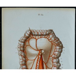 1852 - Artère mésentérique inférieure et coliques 