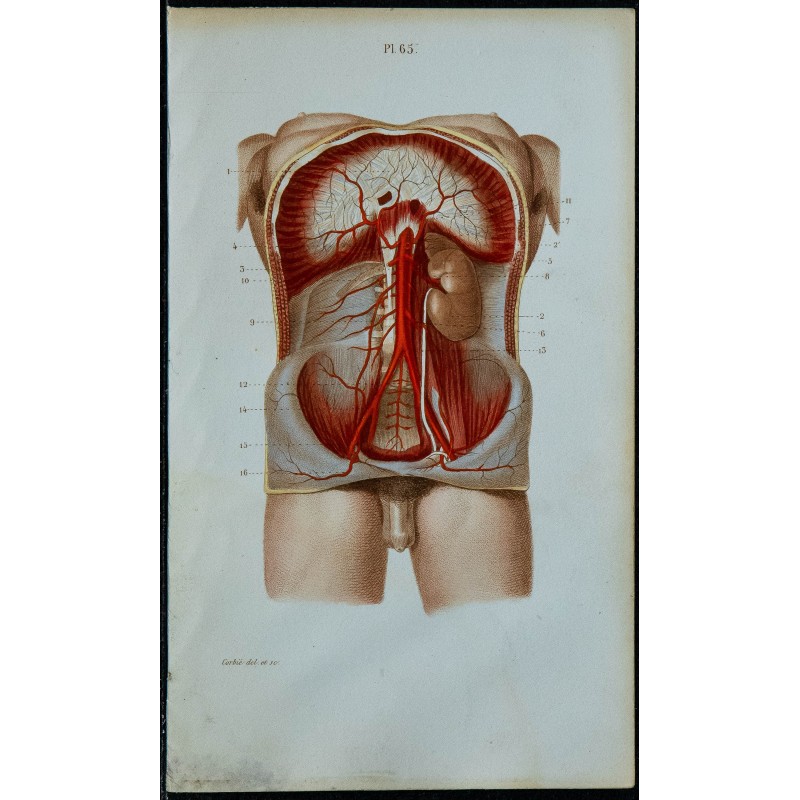 1852 - Aorte abdominale et nombreuses branches 