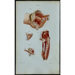 1852 - Terminaison aorte artères iliaques bassin 