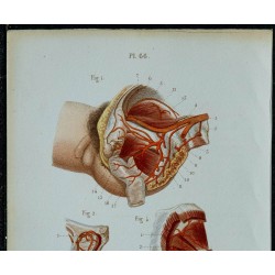 1852 - Terminaison aorte artères iliaques bassin 