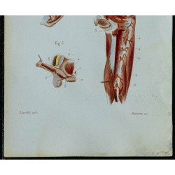 1852 - Terminaison aorte artères iliaques bassin 
