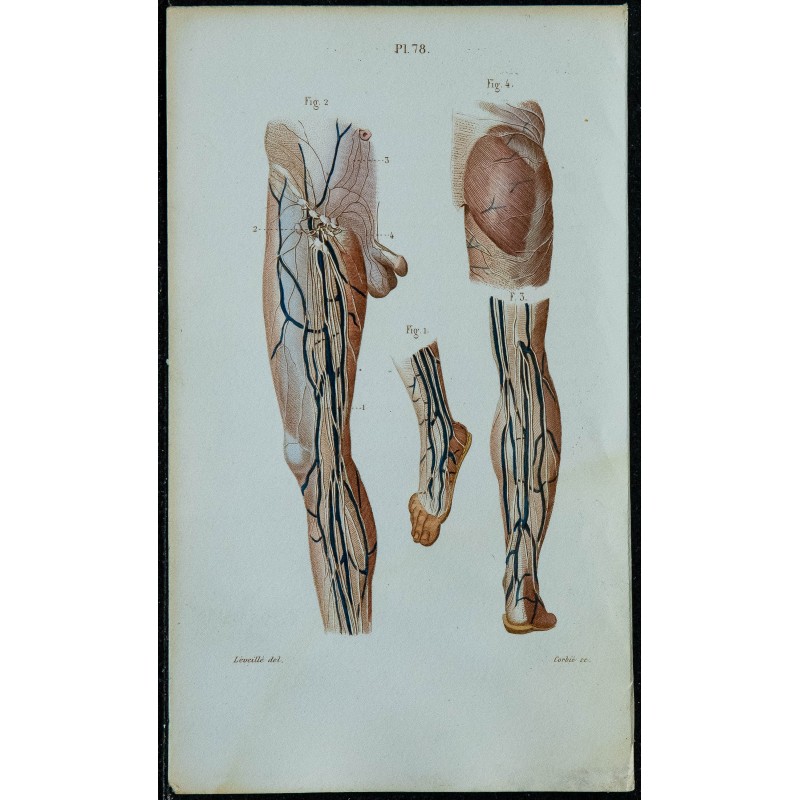 1852 - Vaisseaux et ganglions lymphatiques 