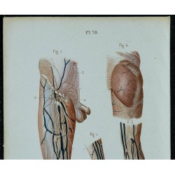 1852 - Vaisseaux et ganglions lymphatiques 
