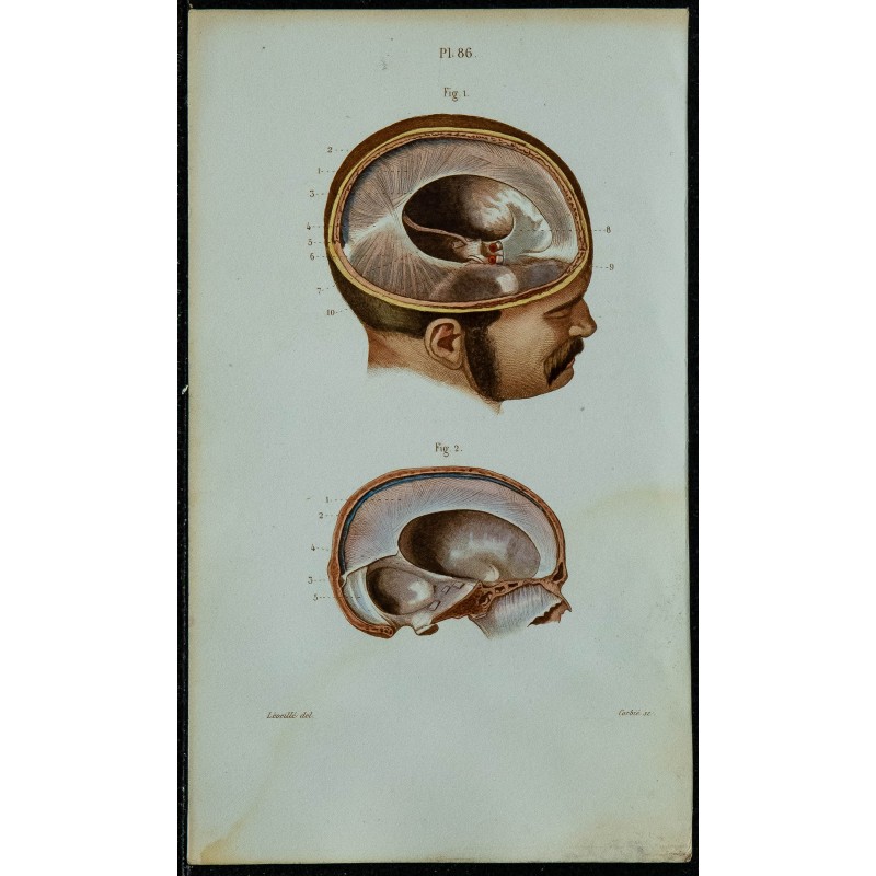 1852 - Anatomie macroscopique de la dure-mère 