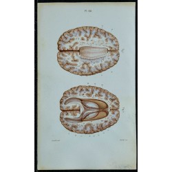 1852 - Corps calleux et plexus choroïdes 