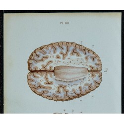 1852 - Corps calleux et plexus choroïdes 