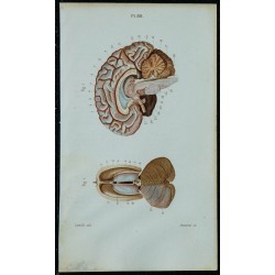 1852 - Ventricules cérébraux et mésencéphale supérieurs 