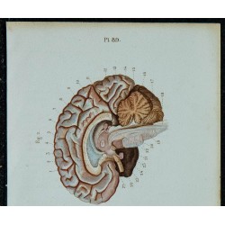 1852 - Ventricules cérébraux et mésencéphale supérieurs 