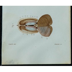 1852 - Ventricules cérébraux et mésencéphale supérieurs 