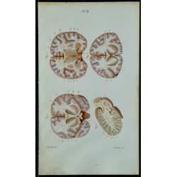 1852 - Coupes du cerveau 