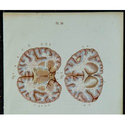 1852 - Coupes du cerveau 