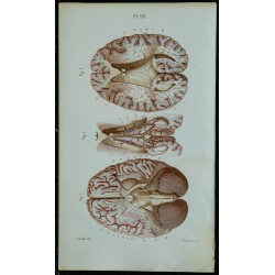 1852 - Cerveau vu en dessous 