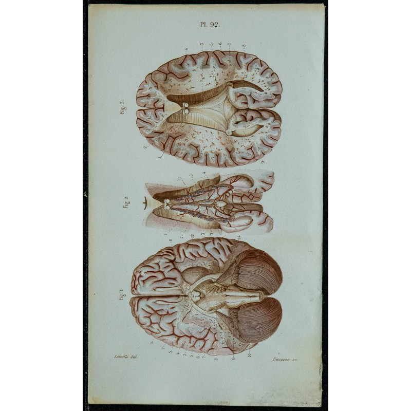 1852 - Cerveau vu en dessous 