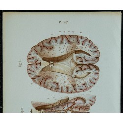 1852 - Cerveau vu en dessous 